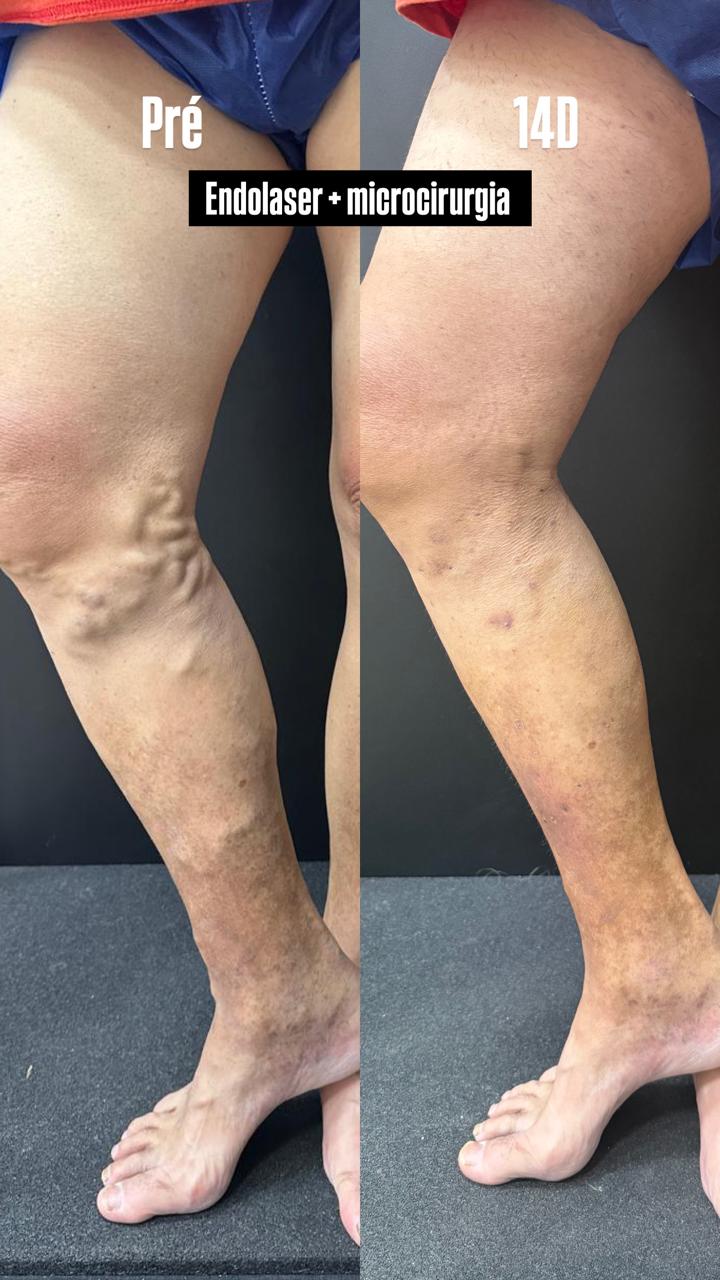 Caso real — Antes e depois 7