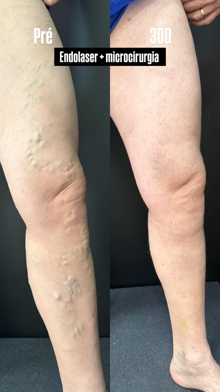 Caso real — Antes e depois 4