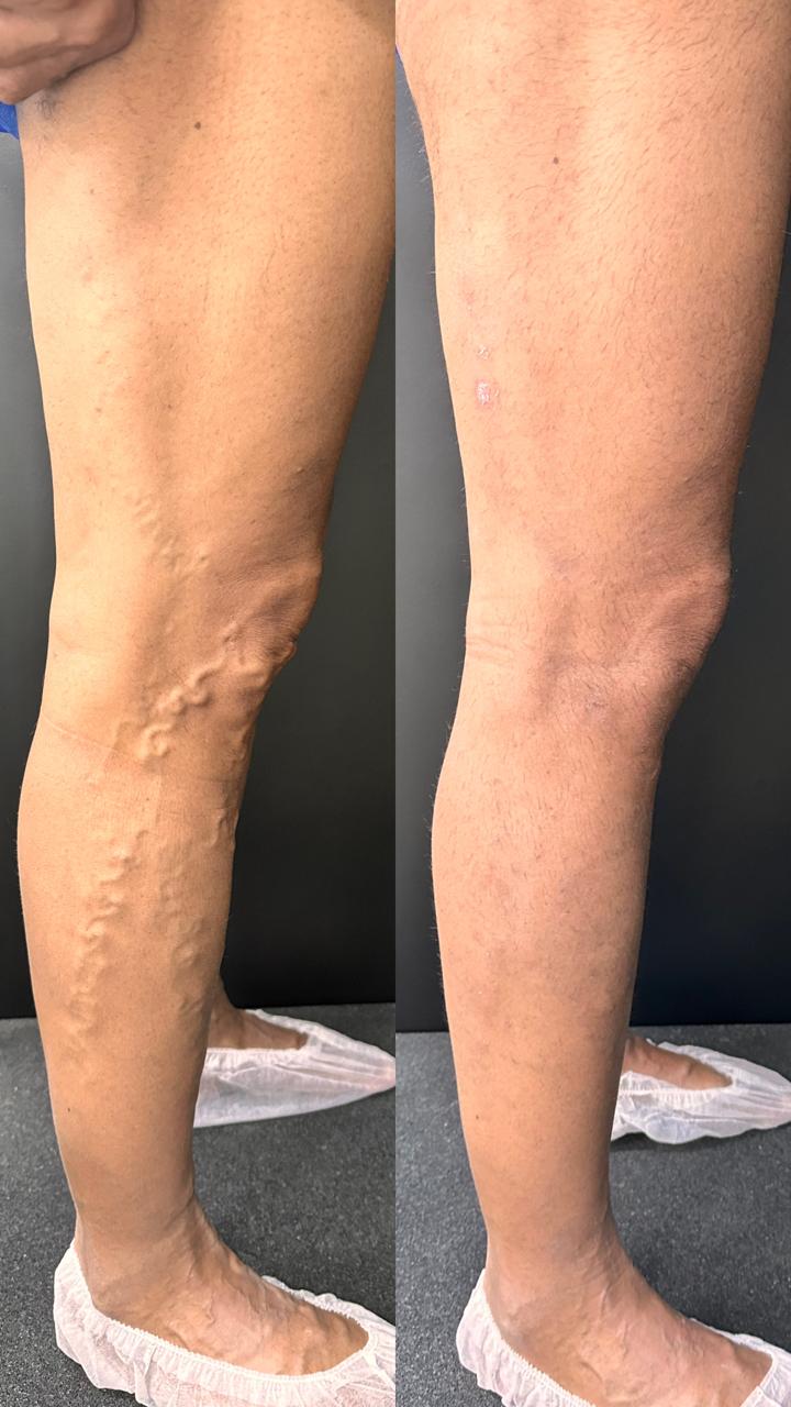 Caso real — Antes e depois 12