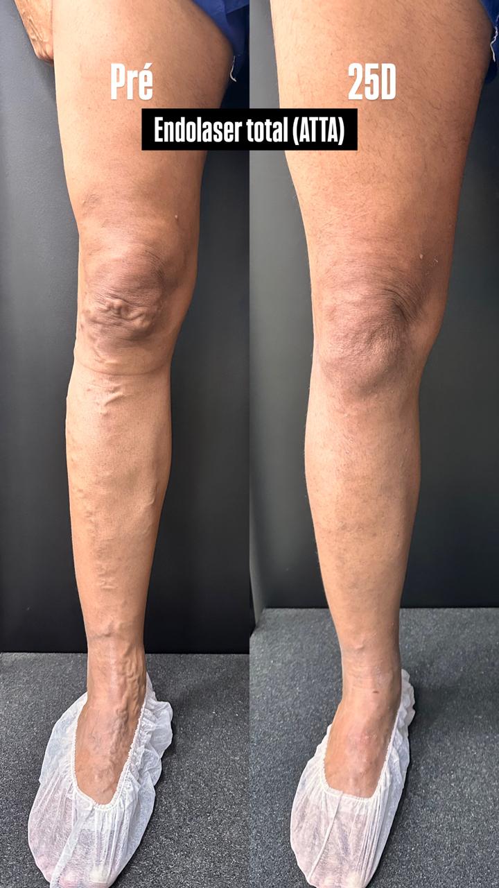 Caso real — Antes e depois 6