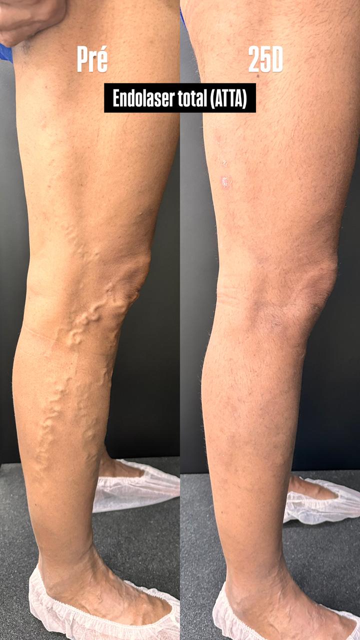 Caso real — Antes e depois 5