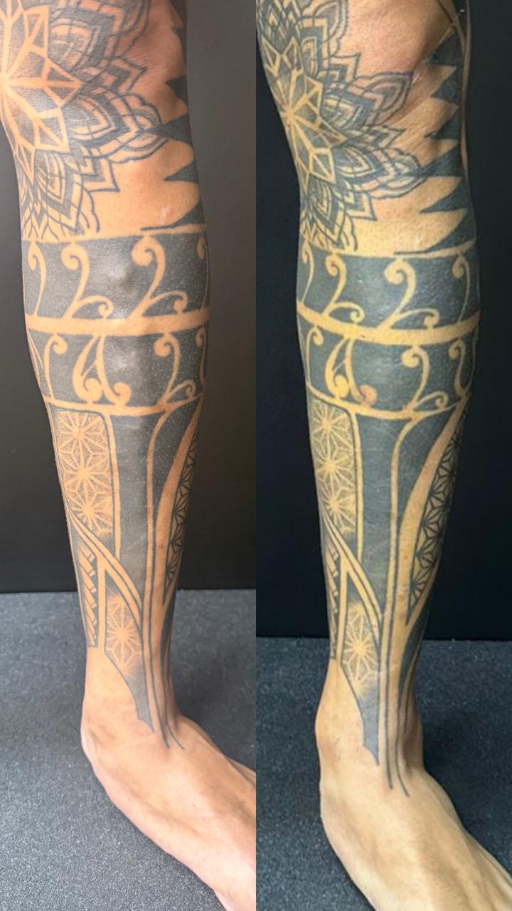 Caso real — Antes e depois 11