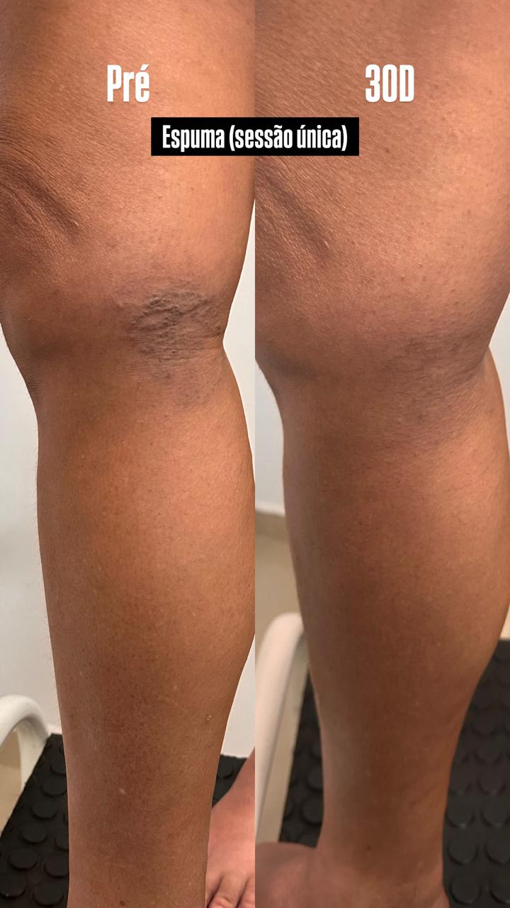 Caso real — Antes e depois 3