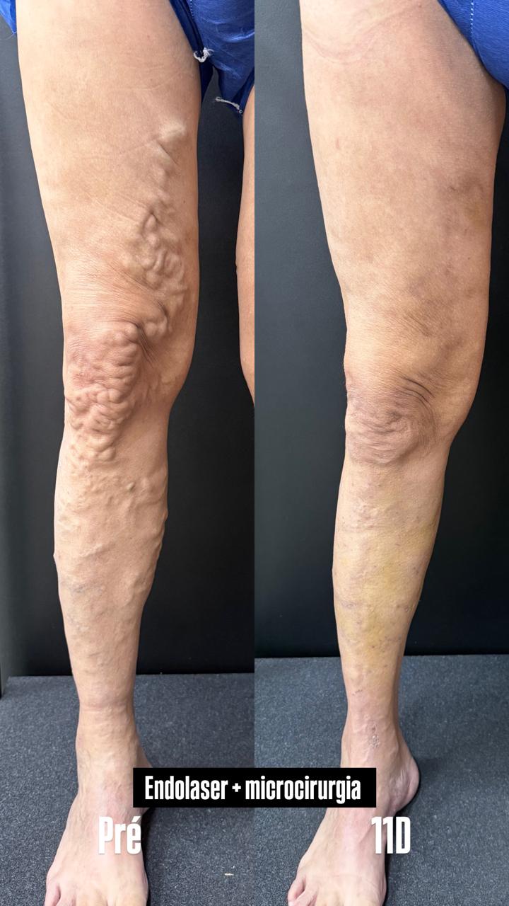 Caso real — Antes e depois 8