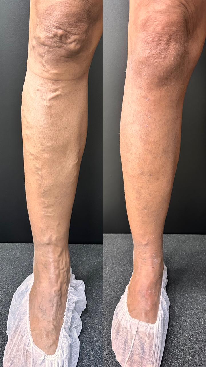 Caso real — Antes e depois 13