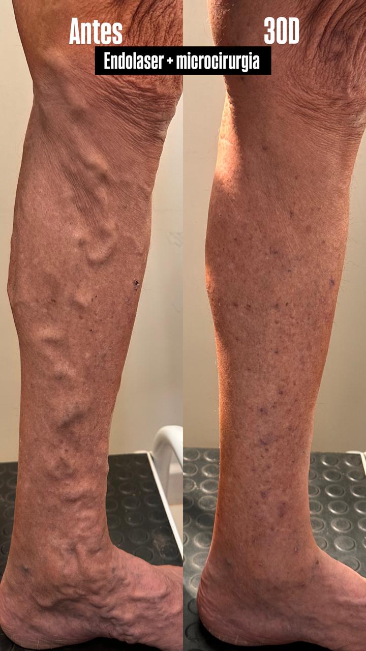 Caso real — Antes e depois 10