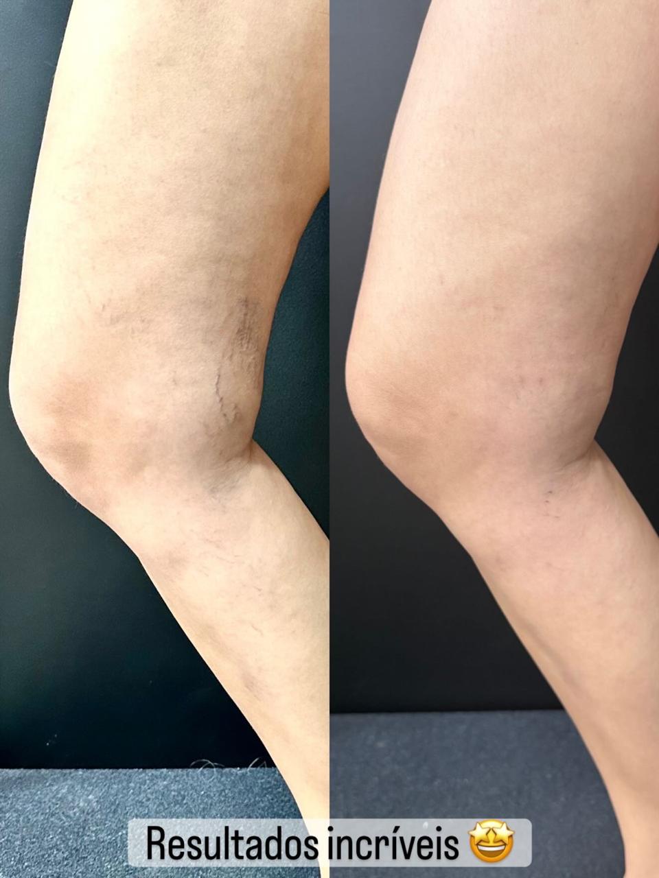 Caso real — Antes e depois 14