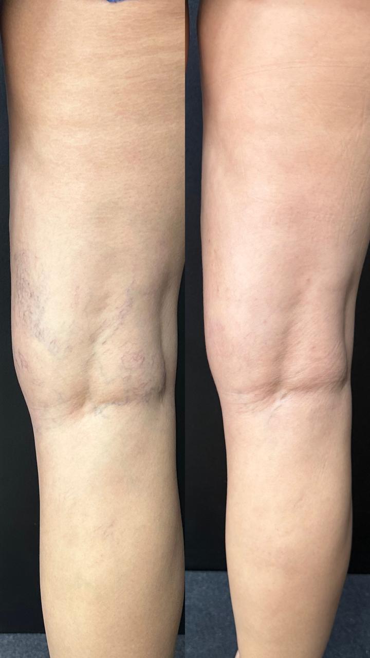 Caso real — Antes e depois 15